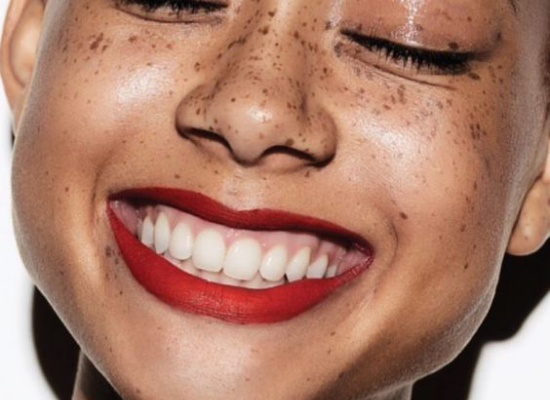 Femme qui sourit avec de belles dents blanches avec Smile Addict