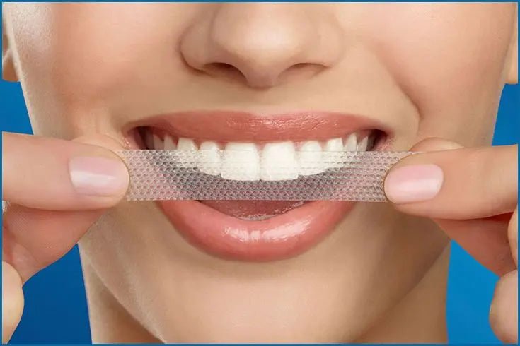 Dents blanches naturellement avec astuces efficaces - Smile Addict