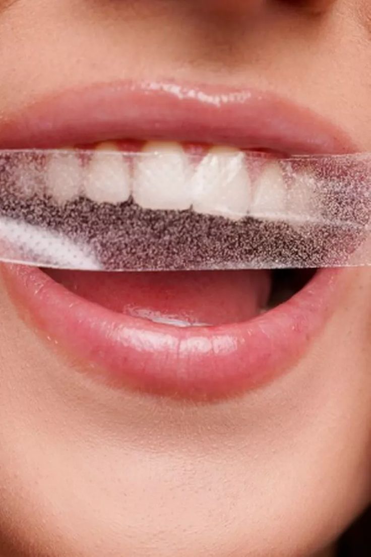 Whitening strips - New PAP+ formula Mint flavored