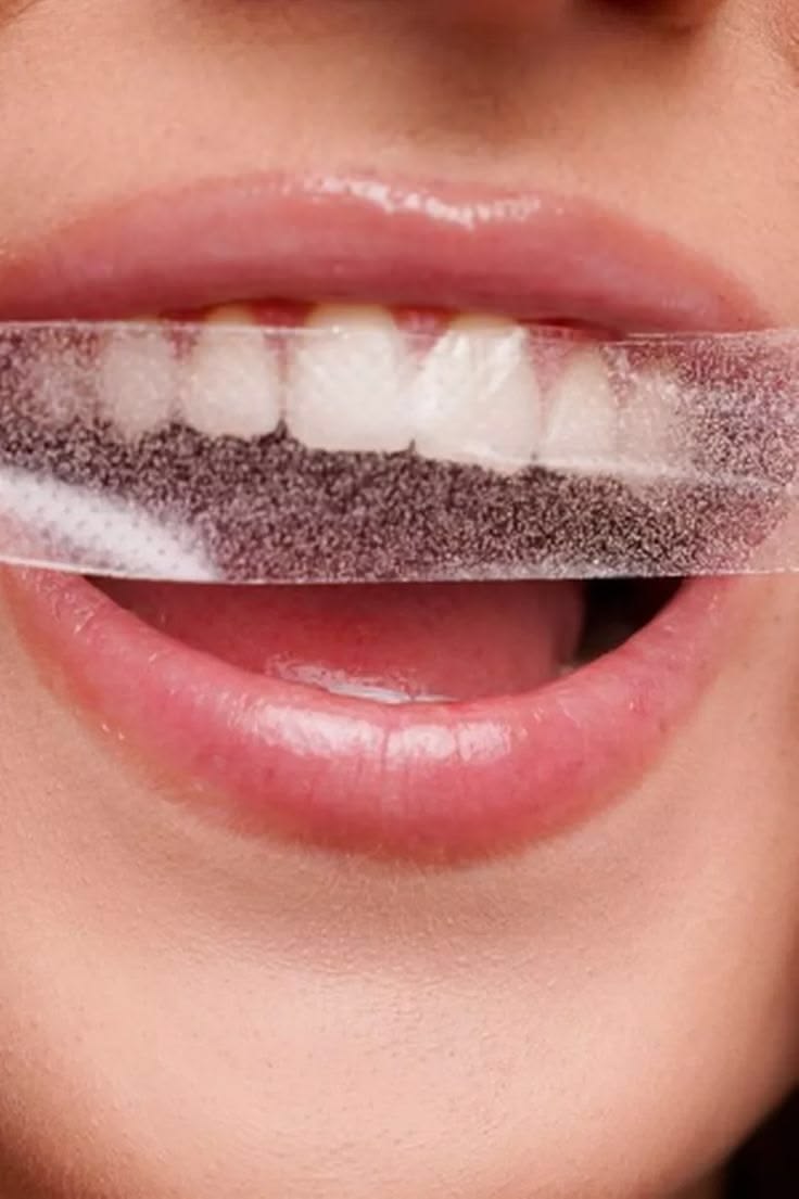 Bandes de blanchiment dentaire PAP Saveur barbe à papa – Smile Addict Smile Addict