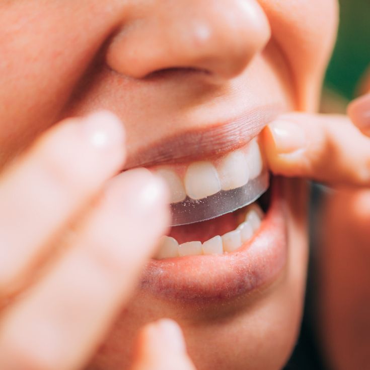 Bandes de blanchiment dentaire PAP Saveur pastèque – Smile Addict Smile Addict