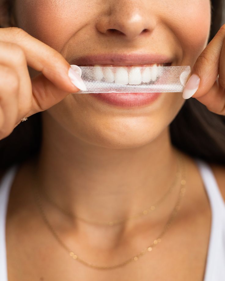 Bandes de blanchiment dentaire PAP Saveur menthe – Smile Addict Smile Addict