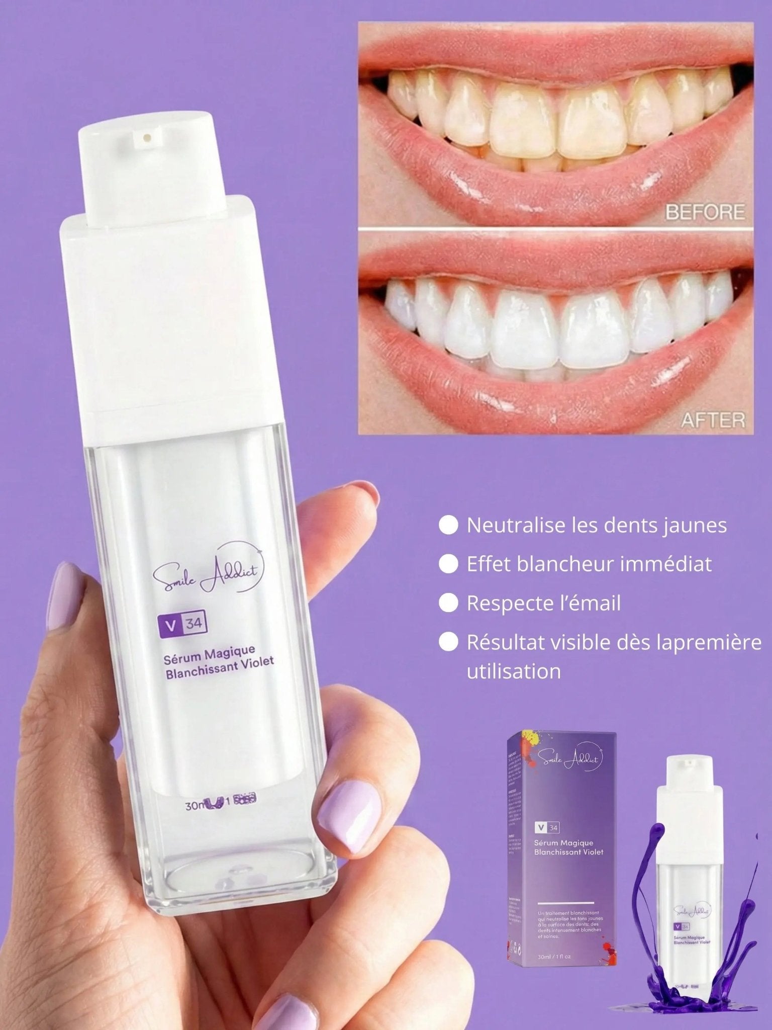 CORRECTEUR DE COULEUR - Serum "magique" blanchissant viole — résultats blanchiment dentaire | Smile Addict