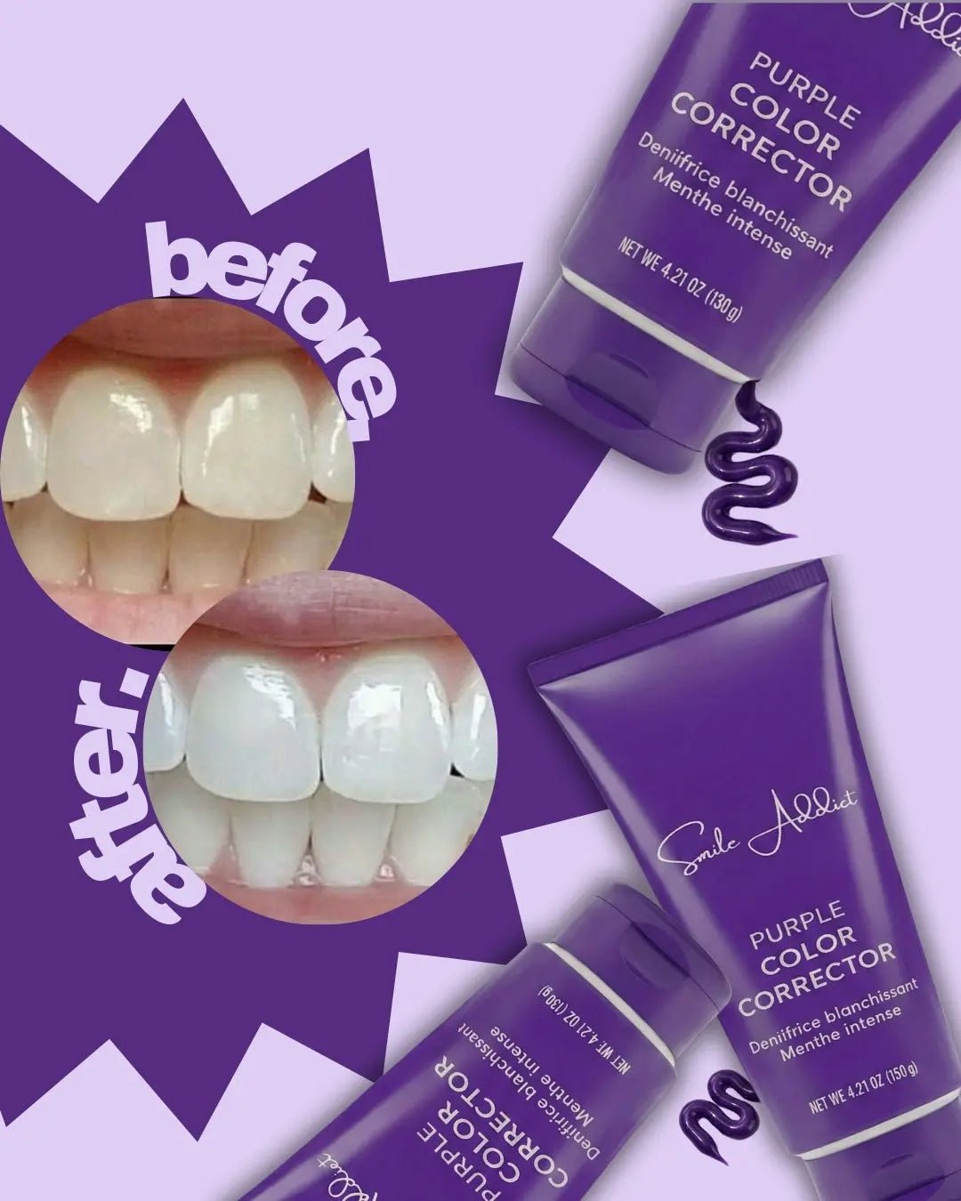 NEW Dentifrice Violet Blanchissant – Big Format 120 G - Blancheur Express - SmileAddict - Smile Addict