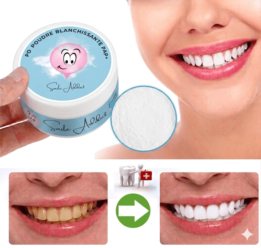 Poudre de Blanchiment Dentaire PAP – Saveur Bubble Gum Che — résultats blanchiment dentaire | Smile Addict